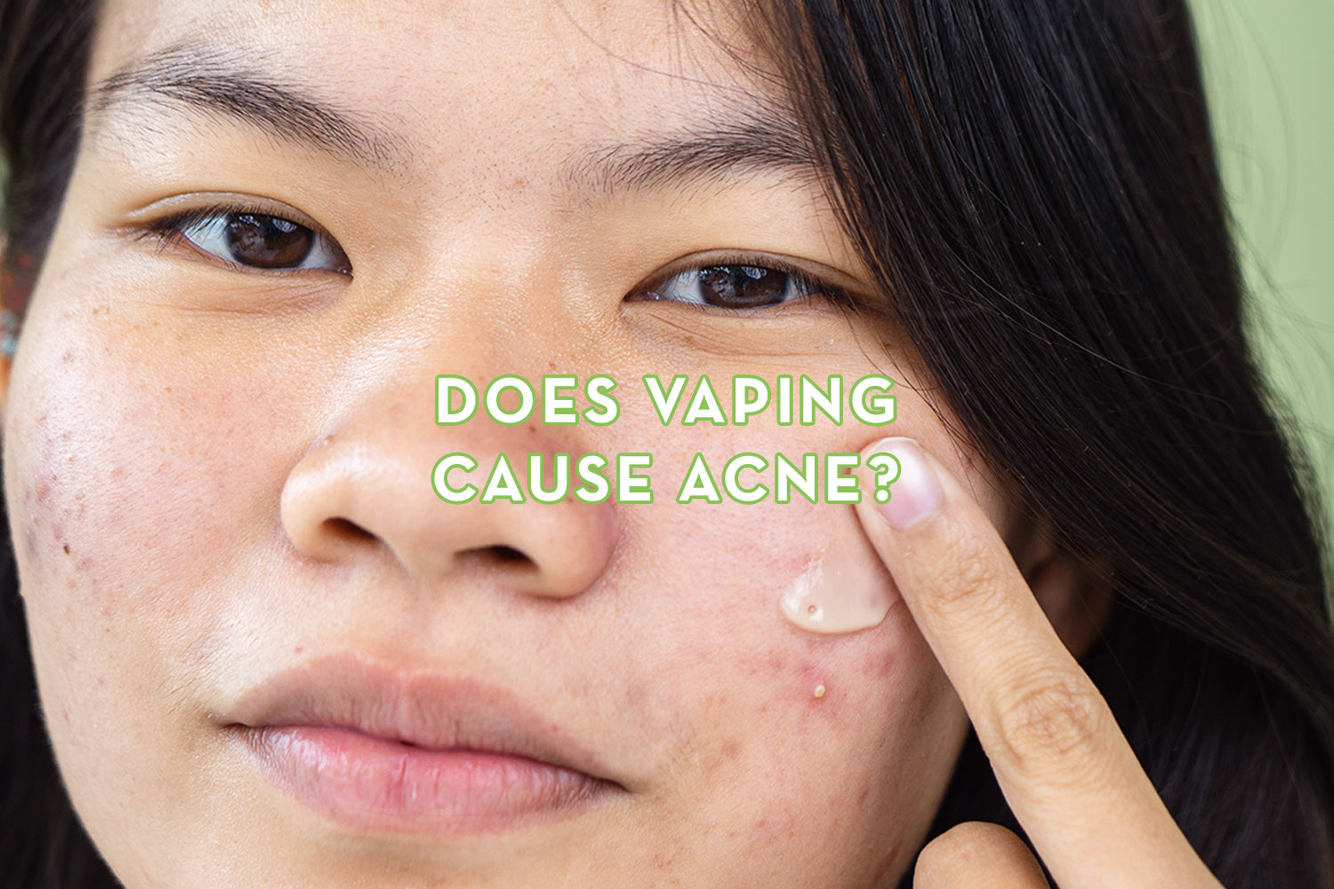 Do electronic cigarettes cause acne? Simple facts you need to know about vaping and breakouts.