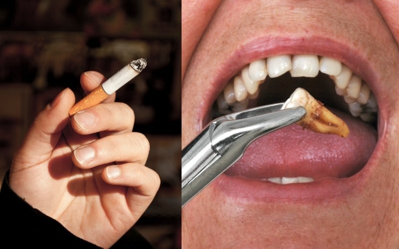 how soon after tooth extraction can u smoke a electronic cigarette read important tips