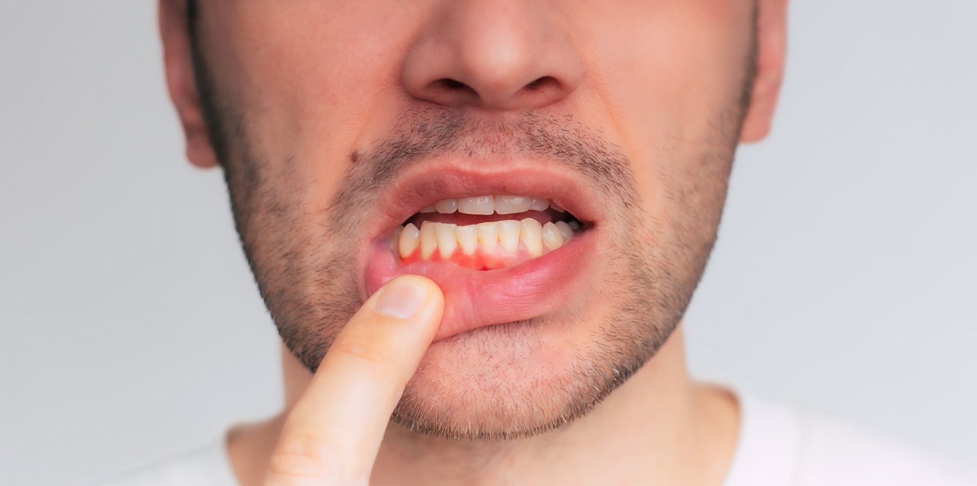 Are Vapes Bad For Your Gums? Simple Steps to Avoid Serious Trouble